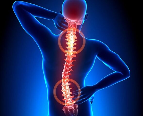 Durerea coloanei vertebrale cu osteocondroză