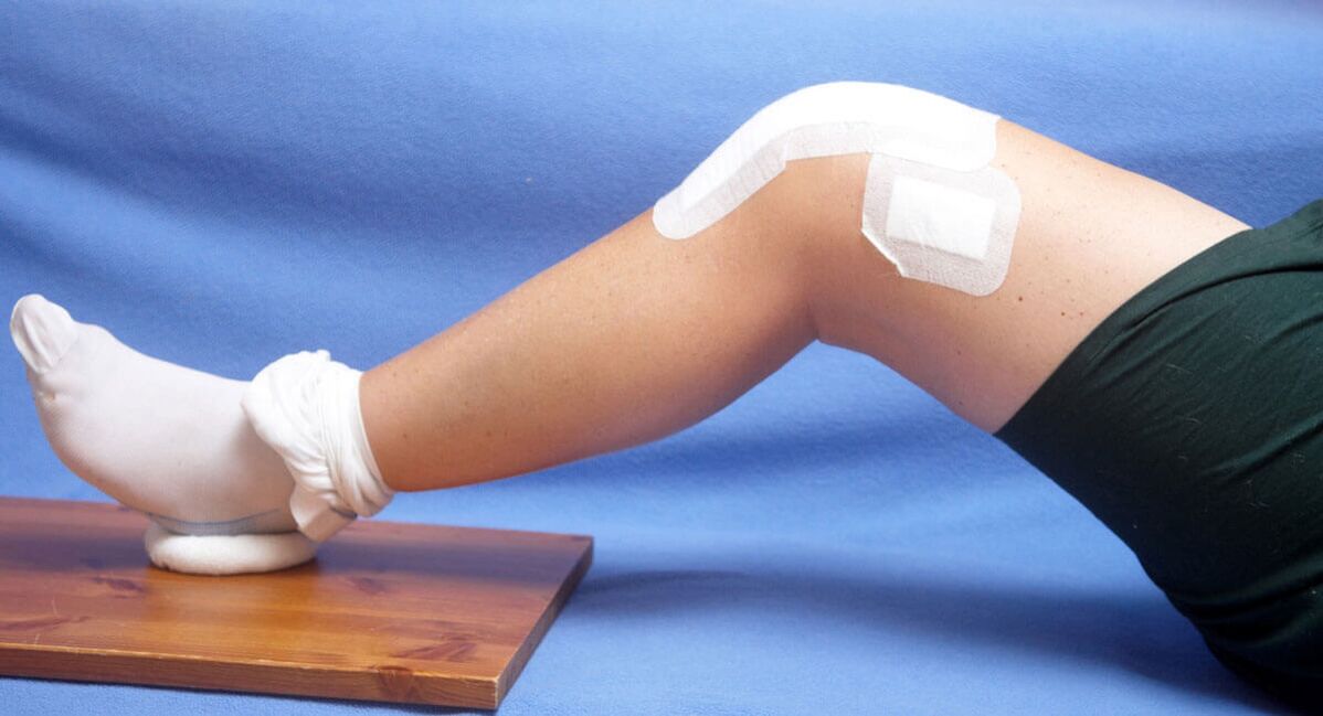 Leziunea genunchiului ca cauză a osteoartritei