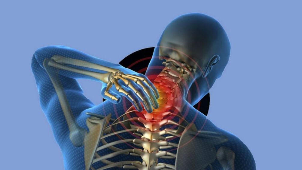 Osteochondroza regiunii colului uterin