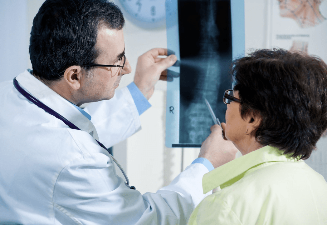 Un neurolog diagnostichează osteocondroza folosind o radiografie a coloanei vertebrale